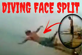 Diving Face Split Accident Videos: Ways to Prevent Serious Injuries