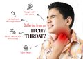 Itchy Throat – Causes, Symptoms, and Effective Remedies