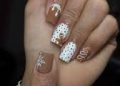 Gingerbread Nails – Nasty Fungus Disease Video